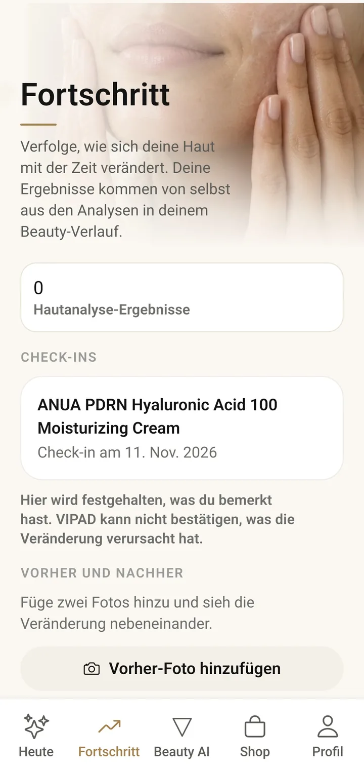 Der Bildschirm Fortschritt in VIPAD