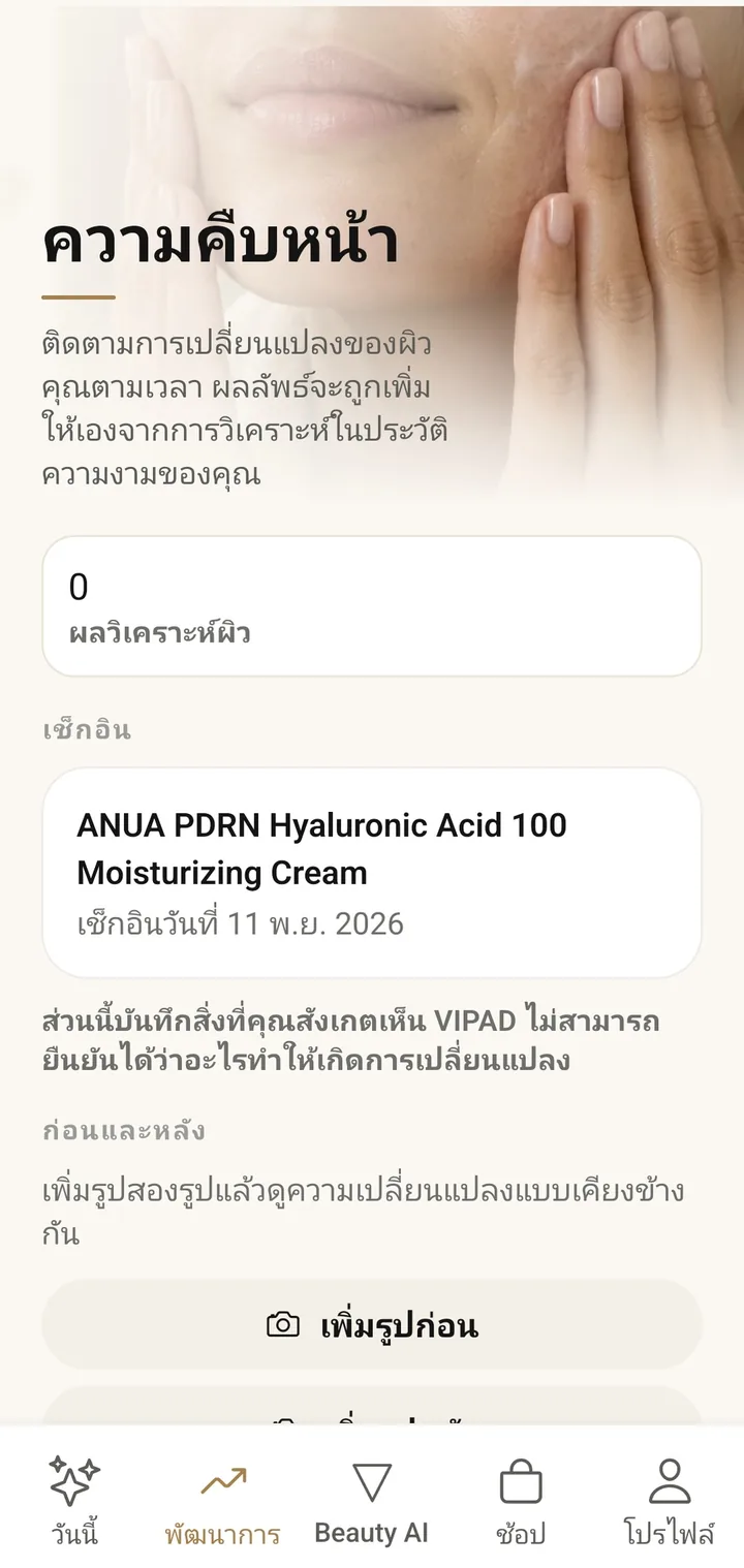 หน้าความคืบหน้าในแอป VIPAD