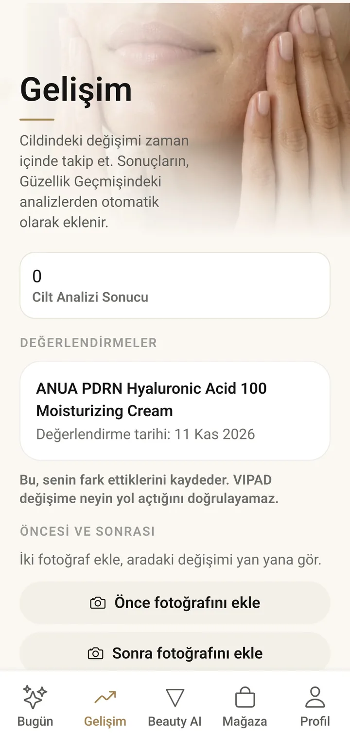 VIPAD'deki Gelişim ekranı